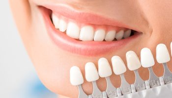 Can Dental Veneers Be Whitened? Tips for Keeping Your Veneers Looking Fresh